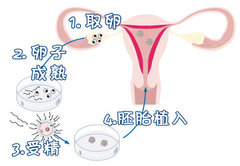 供卵代生公司